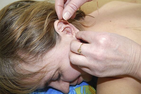 lomber osteokondroz için akupunktur