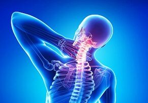 Osteokondroz kavşağı ile olası komplikasyonlar